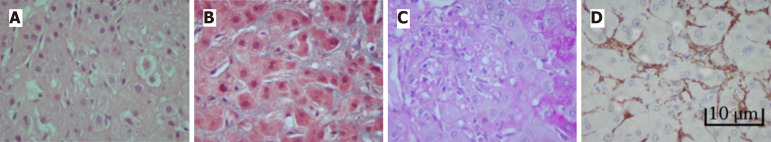 Vitamin A toxicity and hepatic pathology: A comprehensive review.