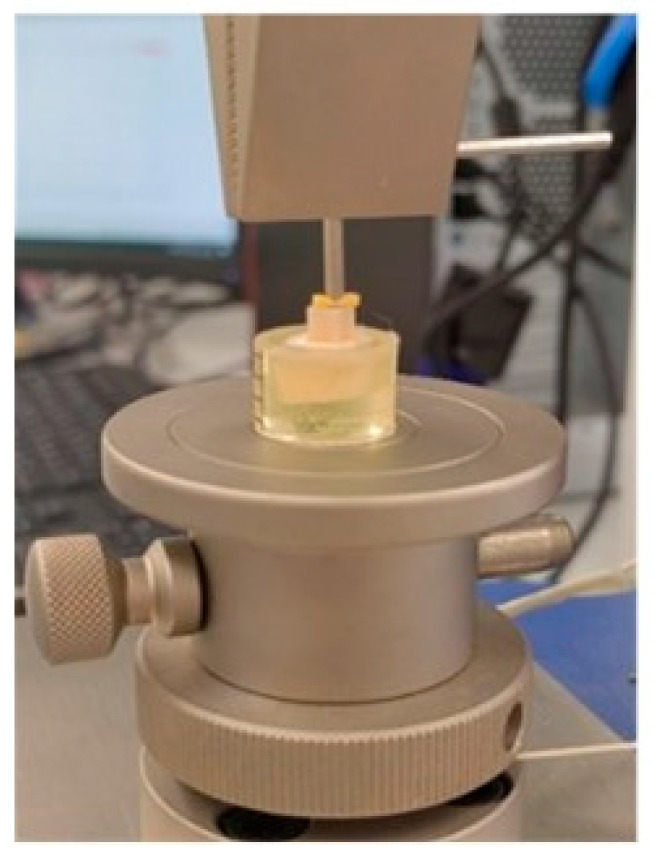 Shear Bond Strength of Self-Adhesive and Self-Etching Resin Cements to Dentin for Indirect Restorations.