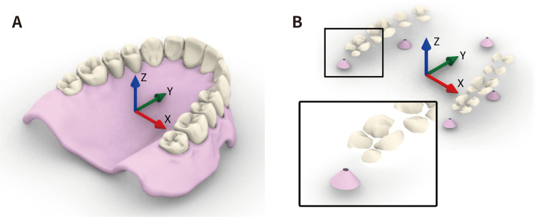 Occlusal teeth surface accuracy of milled complete dentures: a comparison between different manufacturing techniques.