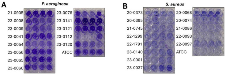 Antimicrobial Effect of Gentamicin/Heparin and Gentamicin/Citrate Lock Solutions on <i>Staphylococcus aureus</i> and <i>Pseudomonas aeruginosa</i> Clinical Strains.