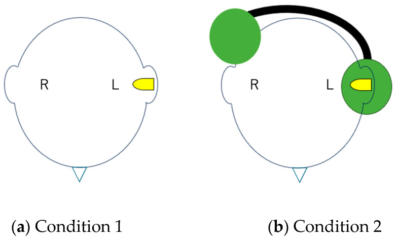 Optimal Sound Presentation Level for Sound Localization Testing in Unilateral Conductive Hearing Loss.