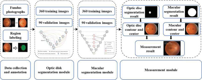 A Novel System for Measuring Eyeball Rotation Angle Based on Color Fundus Photographs in Natural Head Position.