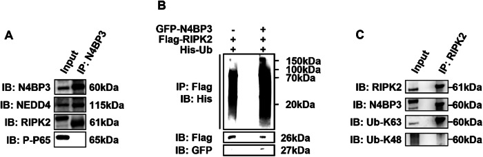 Correction: N4BP3 facilitates NOD2-MAPK/NF-κB pathway in inflammatory bowel disease through mediating K63-linked RIPK2 ubiquitination.