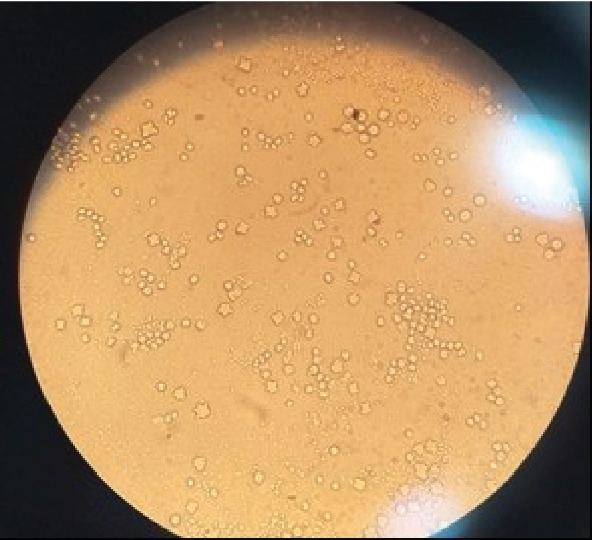 Genotyping of <i>Acanthamoeba</i> From Different Wards of Gonabad Bohlool Hospital, Northeastern Iran.