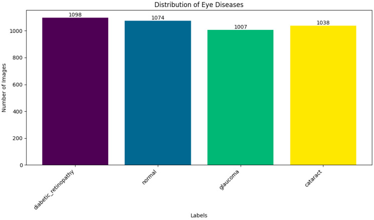 Fundus Image-Based Eye Disease Detection Using EfficientNetB3 Architecture.