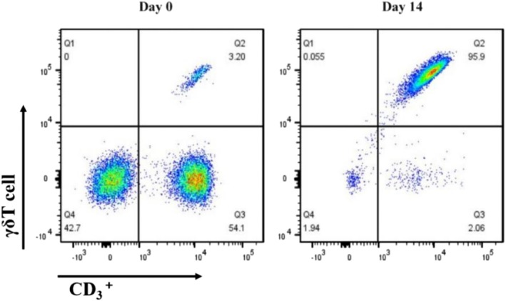 A Preliminary Study on the Therapeutic Role of γδT Cells in Triple-Negative Breast Cancer.