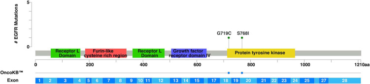 Exceptional Response to Immunotherapy-based Treatment in Compound <i>EGFR</i>-Mutated Oligometastatic Pulmonary Sarcomatoid Carcinoma: A Case Report.