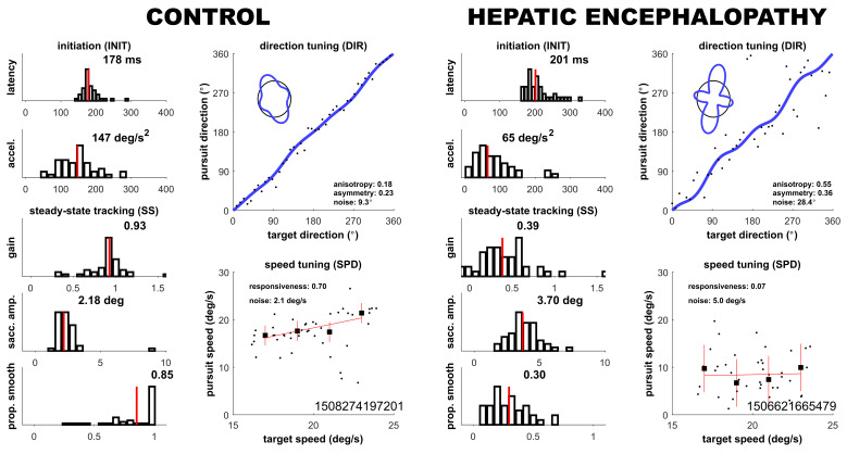Oculometric Assessment of Sensorimotor Impairment Associated with Liver Disease Is as Sensitive as Standard of Care Cognitive Tests.