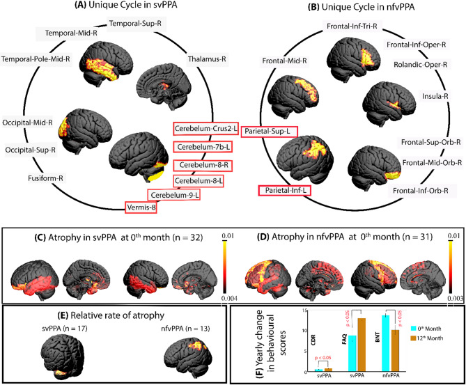 Longitudinal evaluation of common and unique brain-networks in variants of primary progressive aphasia.