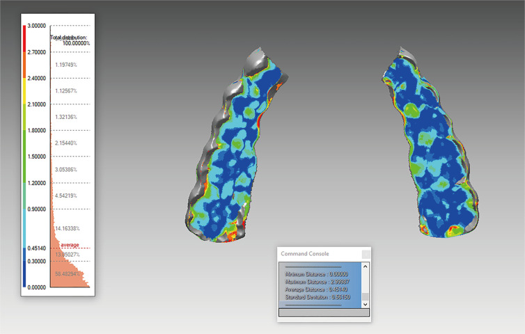 Impact of digital jaw tracking systems on dynamic occlusal surface morphology and condylar inclination measurements.