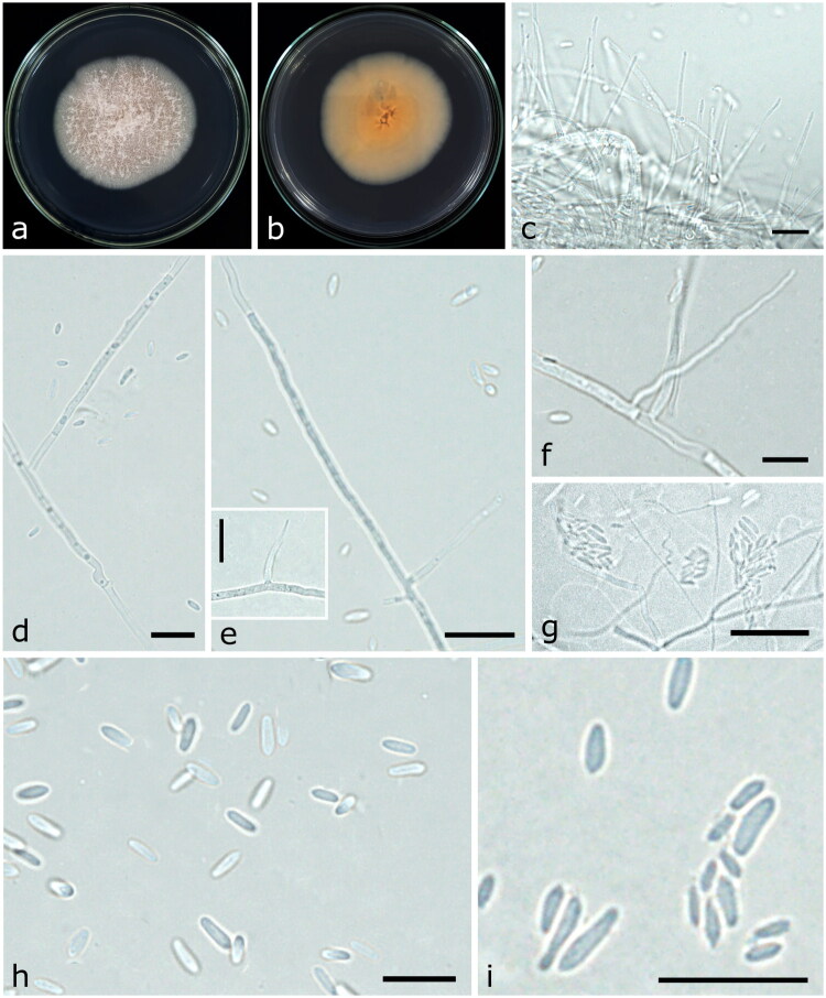 <i>Acremonium quercivorum</i> (<i>Hypocreales, Sordariomycetes</i>), a New Species from Oak (<i>Quercus</i> spp.) Growing in Algeria.