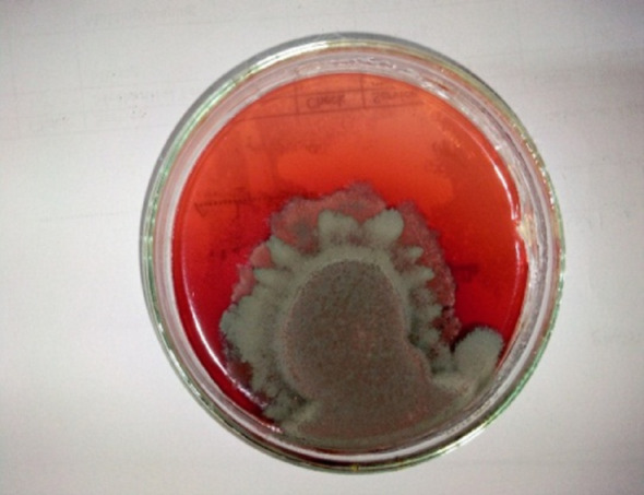 Mycofabrication of sustainable mycelium-based leather using Talaromyces sp. and irradiated eggplant peel waste.