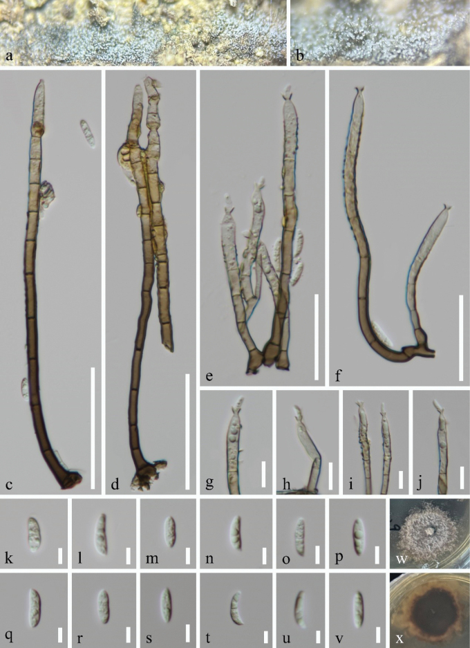 ﻿Two new species of <i>Stilbochaeta</i> (Chaetosphaeriaceae, Chaetosphaeriales) from freshwater and terrestrial habitats in China.