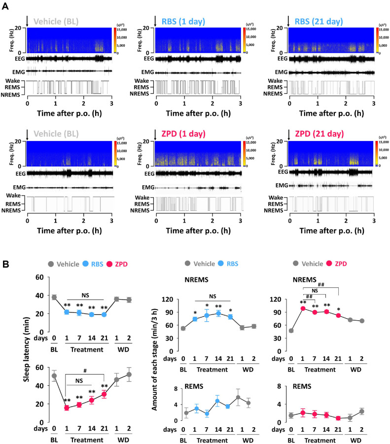 Effects of Chronic Administration of a Standardized Rice Bran Supplement on Sleep Architecture and Profiles in Mice: A Comparative Study with a Hypnotic Drug Zolpidem.