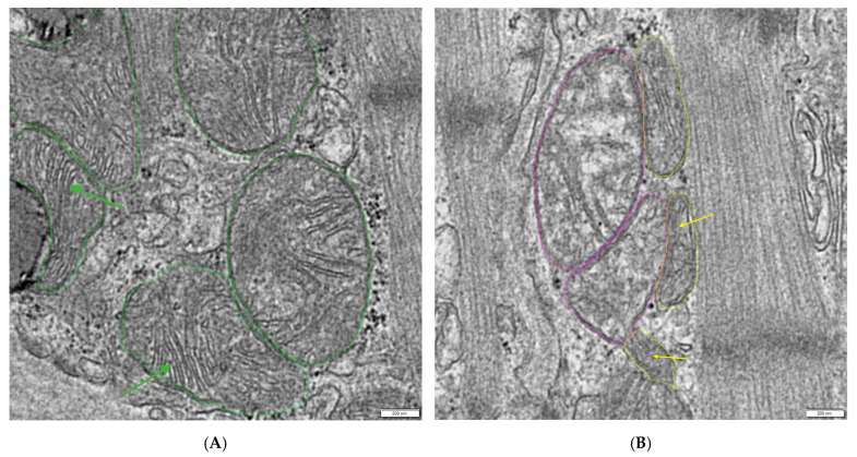 Protocol for the Systematic Quantitative Ultrastructural Analysis of Mitochondria in Cardiac Tissue.