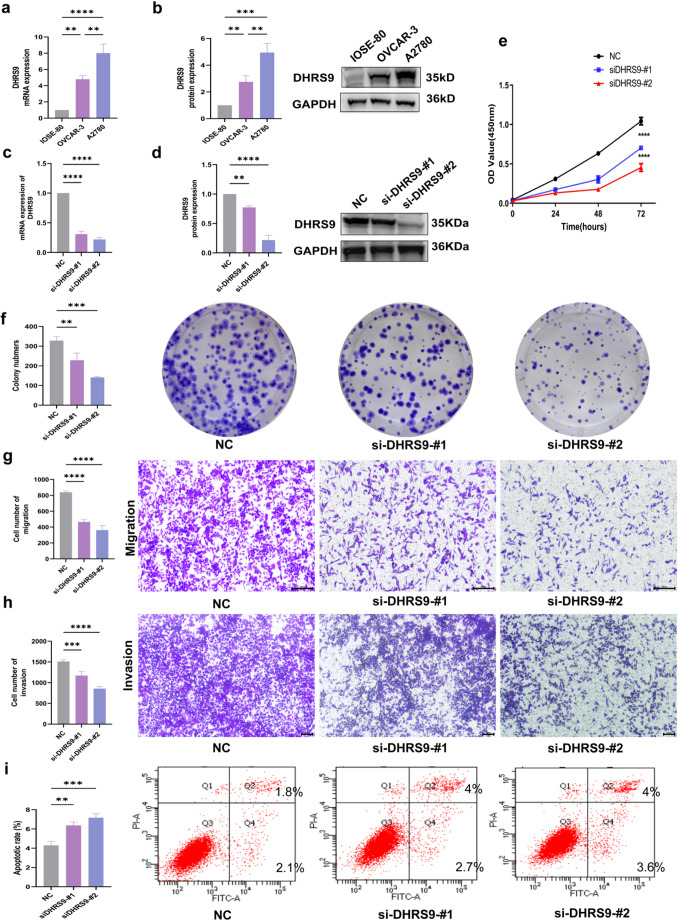 DHRS9 promotes malignant progression of ovarian cancer through SQSTM1.
