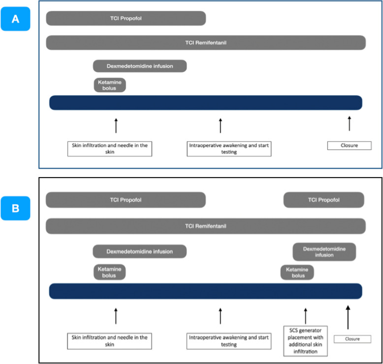 Multimodal sedation guided by processed electroencephalography and autonomic nervous system monitoring for spinal cord stimulator implantation: retrospective identification of anesthetic drug doses.