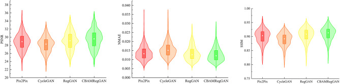 Reducing radiomics errors in nasopharyngeal cancer via deep learning-based synthetic CT generation from CBCT.