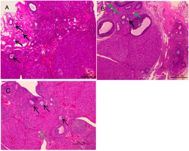 Protective effect of ammonium trichloride tellurate (AS101) on ovarian injury induced by chemotherapy drug doxorubicin in rats.