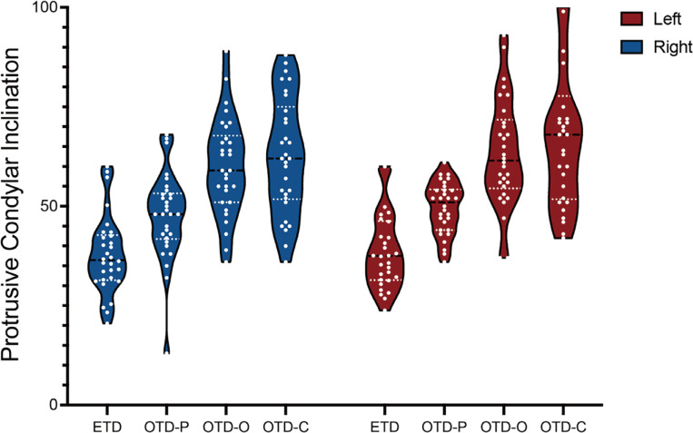 Impact of digital jaw tracking systems on dynamic occlusal surface morphology and condylar inclination measurements.