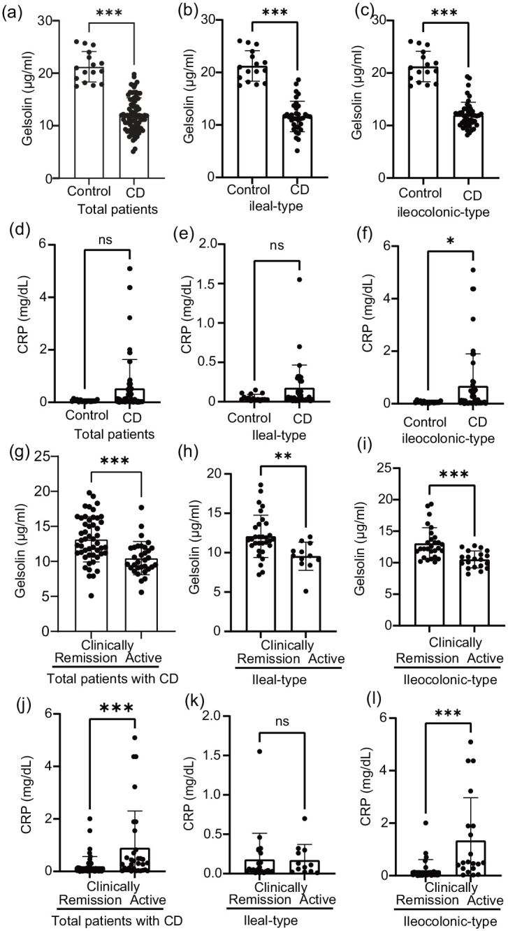 Performance of serum gelsolin as a biomarker for mucosal activity in Crohn's disease: a comparison with C-reactive protein.