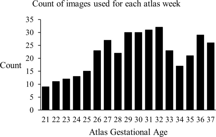 An MRI Atlas of the Human Fetal Brain: Reference and Segmentation Tools for Fetal Brain MRI Analysis.