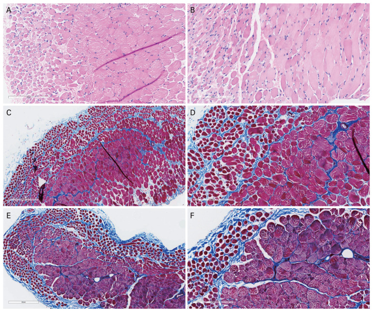 Development of a Flexible Electrode for Electrical Stimulation of Rabbit Extraocular Muscle.