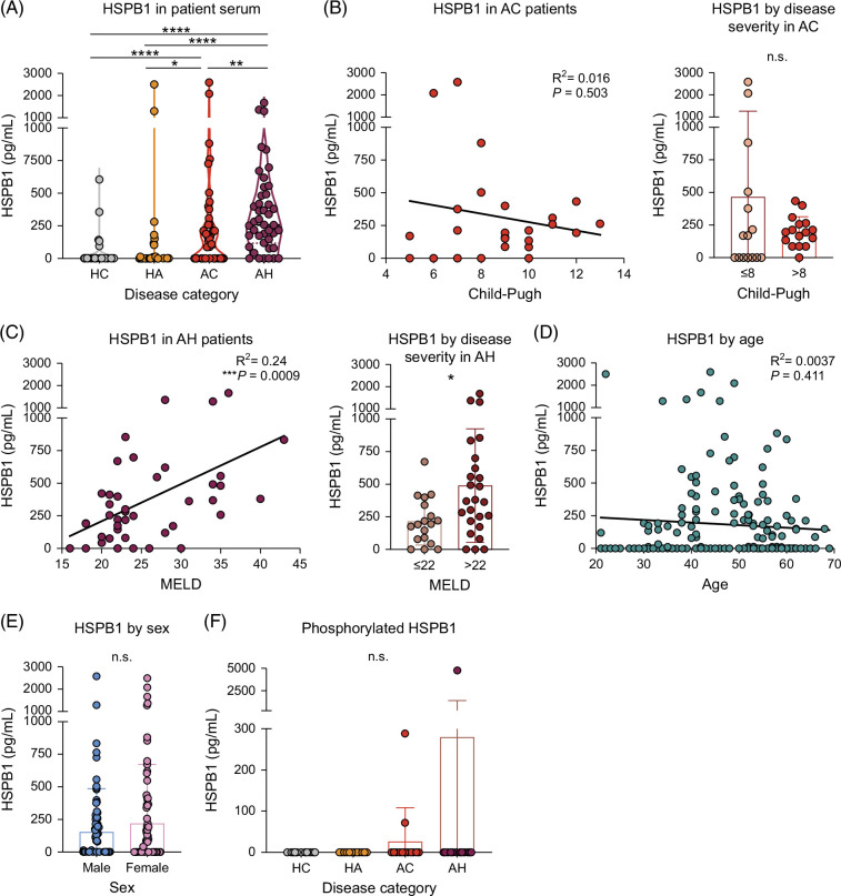 Evidence that extracellular HSPB1 contributes to inflammation in alcohol-associated hepatitis.