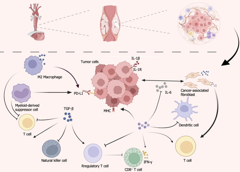 Unmasking immune checkpoint resistance in esophageal squamous cell carcinoma: Insights into the tumor microenvironment and biomarker landscape.