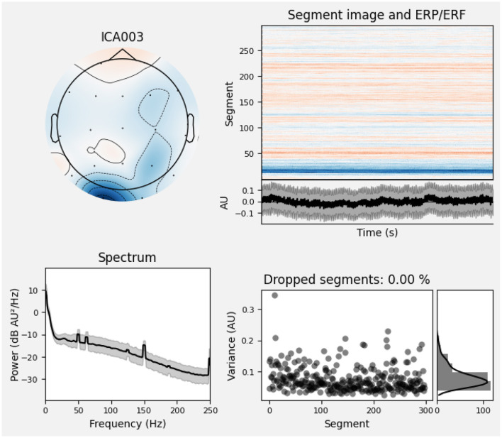 Privacy-preserving dementia classification from EEG via hybrid-fusion EEGNetv4 and federated learning.