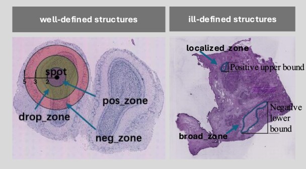 ST-deconv: an accurate deconvolution approach for spatial transcriptome data utilizing self-encoding and contrastive learning.