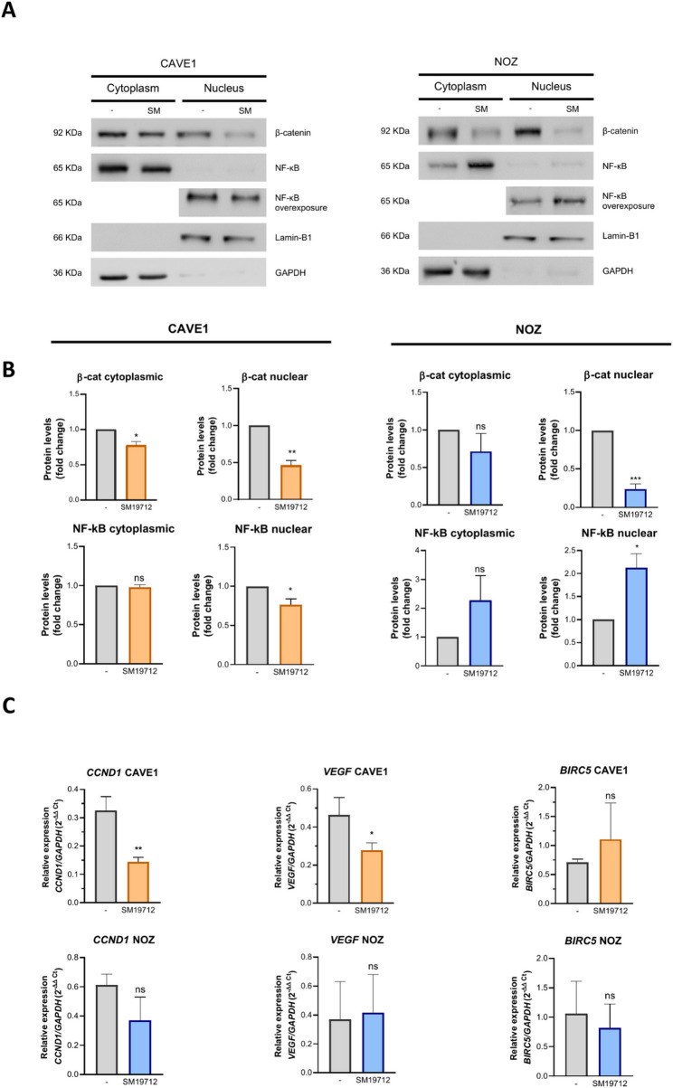 Decreased Endothelin-1 bioavailability impairs aggressiveness of gallbladder cancer cells.