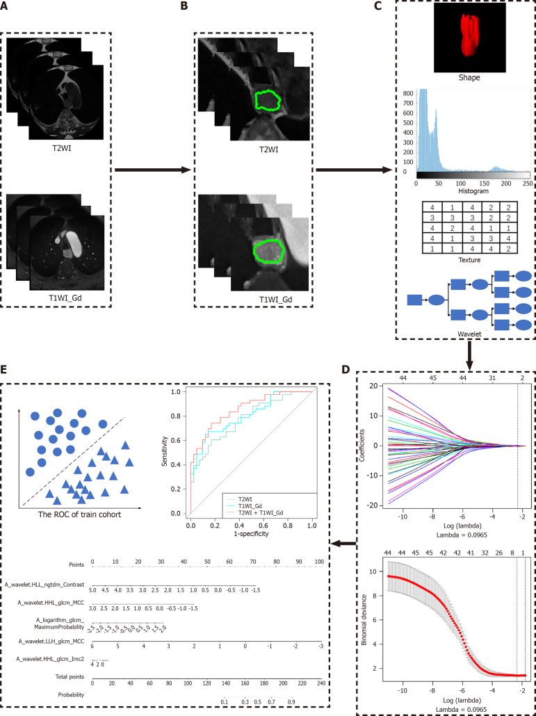 Magnetic resonance imaging-based radiomics signature for predicting preoperative staging of esophageal cancer.