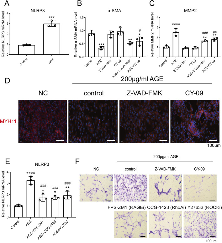 Mechanisms of AGE-induced VSMC phenotypic switching and macrophage modulation in human abdominal aortic aneurysms.