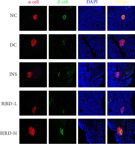 Baihu Jia Renshen Decoction Improves Type 1 Diabetic Rats by Modulating Metabolic Profile.