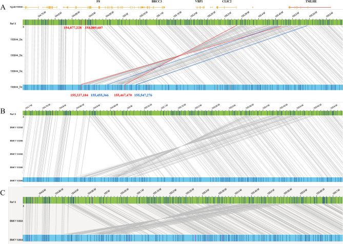 Identification of an F8 complex recombination in Chinese hemophilia a patient using long-read sequencing and optical genome mapping.