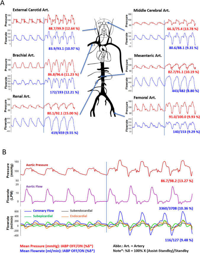 Development of an Anatomy-Mimicking, Wave Transport-Preserving Mock Circulation Loop for Evaluating Pulsatile Hemodynamics as Supported by Cardiovascular Assist Devices.