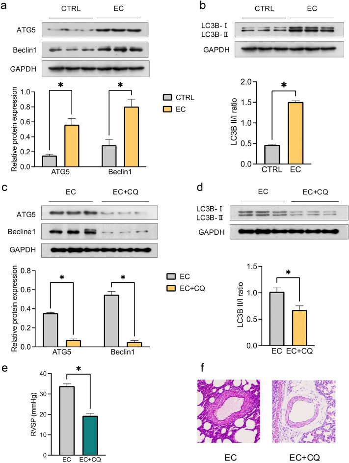 Maternal Electronic Cigarette Exposure Induces Dysregulation of Autophagy via Oxidative Stress/DNA Methylation in Pulmonary Hypertension Offspring.