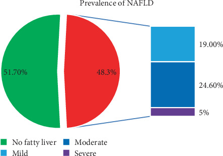 Assessing Nonalcoholic Fatty Liver Disease in Type 2 Diabetes Patients at a Tertiary Hospital, Addis Ababa, Ethiopia.
