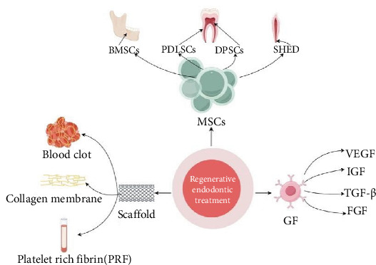 Effect of Oral Pathogens Associated With Pulpitis and Apical Periodontitis on Odontogenic Mesenchymal Stem Cells.