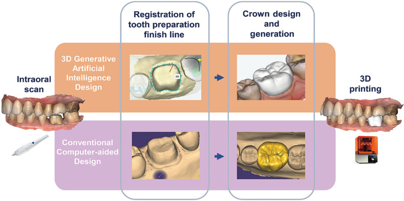 Fit accuracy of complete crowns fabricated by generative artificial intelligence design: a comparative clinical study.