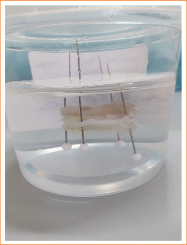 A standardized protocol for anal fistula induction in a rat model.