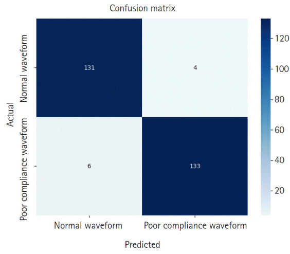 Deep learning-based model for detection of intracranial waveforms with poor brain compliance in southern Thailand.