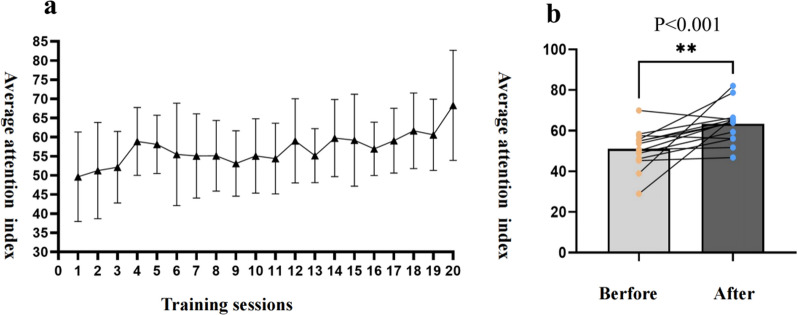 Effects of dual-task mode brain-computer interface based on motor imagery and virtual reality on balance and attention in patients with stroke: a randomized controlled pilot trial.