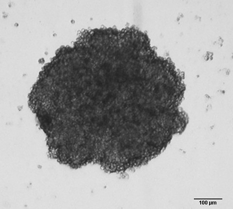 Chrysin induces cell death and inhibits migration and invasion in squamous cervical carcinoma using a three-dimensional cell culture model.