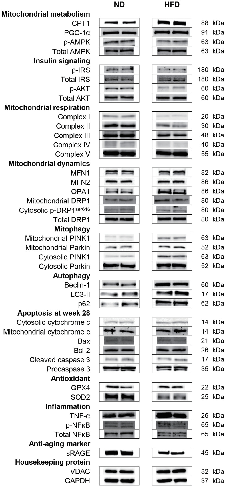 Corrigendum: Correction of Figure. High Cardiorespiratory Fitness Protects against Molecular Impairments of Metabolism, Heart, and Brain with Higher Efficacy in Obesity-Induced Premature Aging.