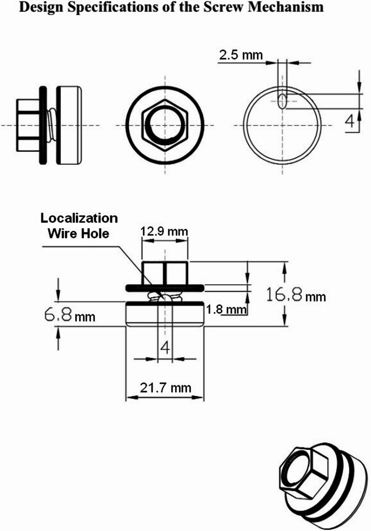 A 3D-printed screw mechanism as an alternative method to prevent wire migration in nonpalpable breast lesion localization.
