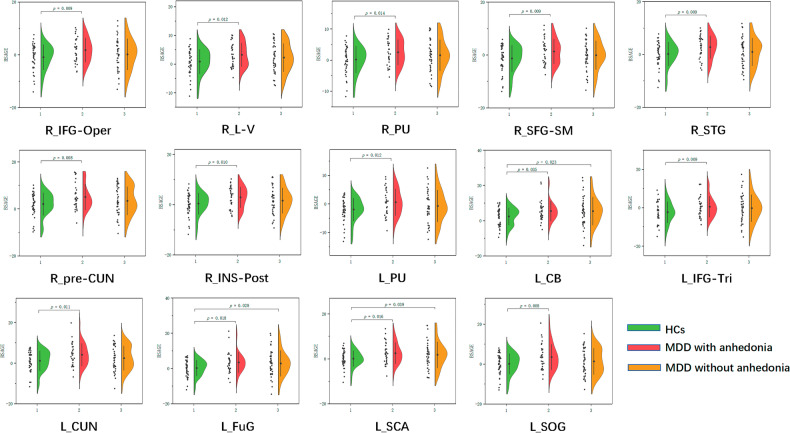 Altered brain structure age gap estimation in major depressive disorder patients with and without anhedonia: a machine learning-based study.