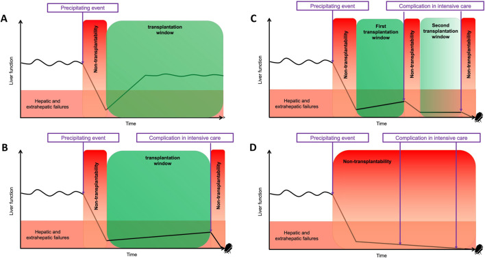 Liver Transplantation in the Context of Acute-On-Chronic Liver Failure (ACLF): Where Do We Stand in 2025?