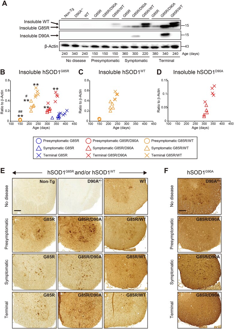 Diverse effects of coexpression of human SOD1 variants on motor neuron disease.
